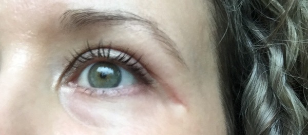 Update on my upper eyelid surgery and brow lift - 3 months down the line