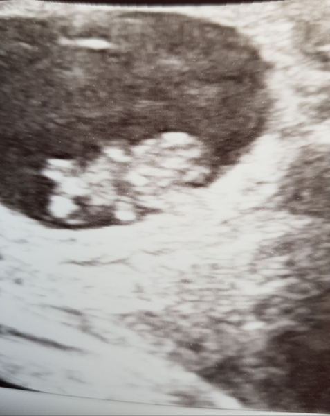 9WK Ultra sound internal or external .. and what will we see?