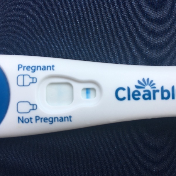 Line eyes ? Preg post erpc