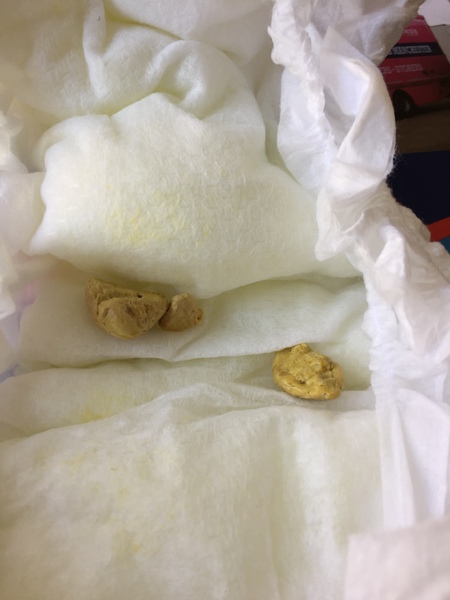 Weird poo - WARNING PHOTO
