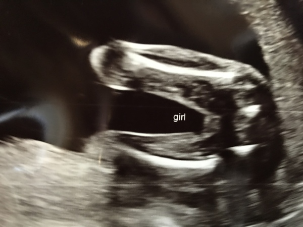 Opinions on accuracy of my gender scan :-)
