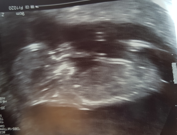 December 2018 Babies - Thread #2