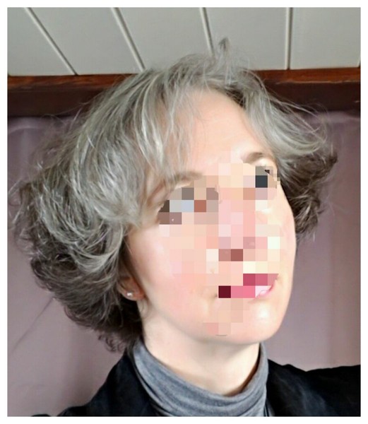 Quitting hair dye and embracing the grey