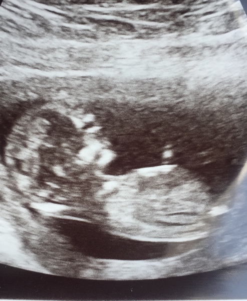Have a guess at gender