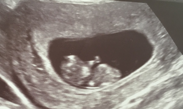 Newbie to the pregnancy board! Due end of December.. anyone else due around the same time?