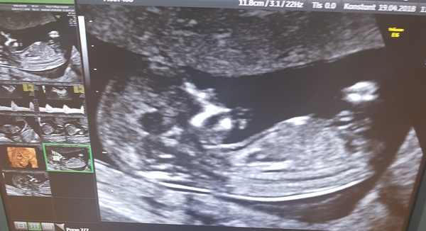 Boy or girl?