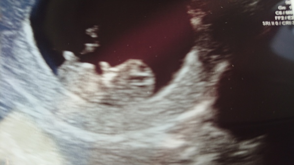 December 2018 Babies - Thread #2