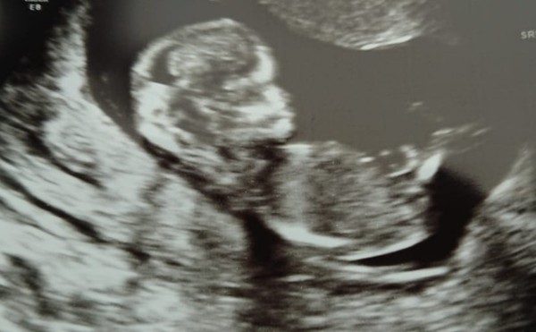 December 2018 Babies - Thread #2