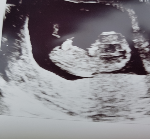 BFPs after MC - Christmas Cake for Christmas Babies - Thread 1