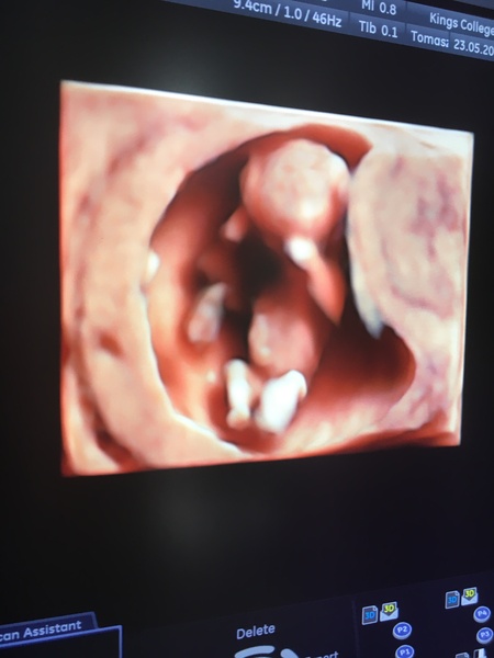 December 2018 Babies - Thread #2