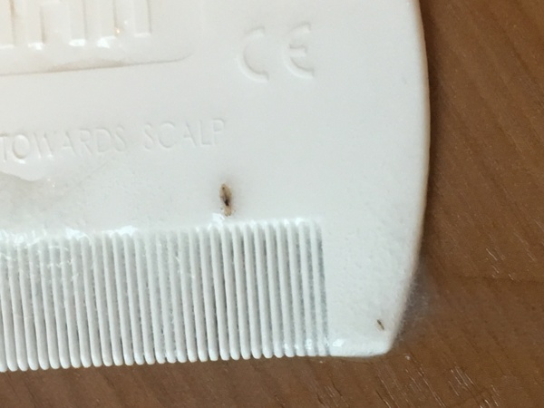 Are these headlice?