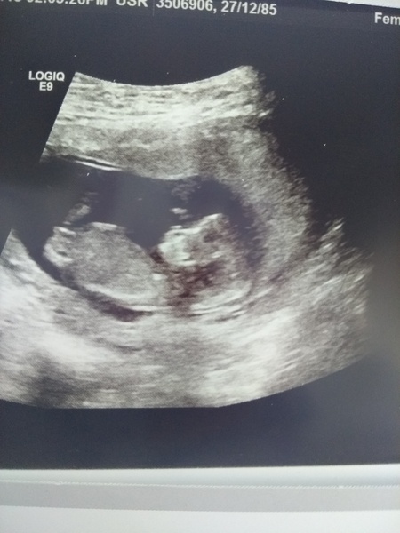 Just for fun: what's the gender!