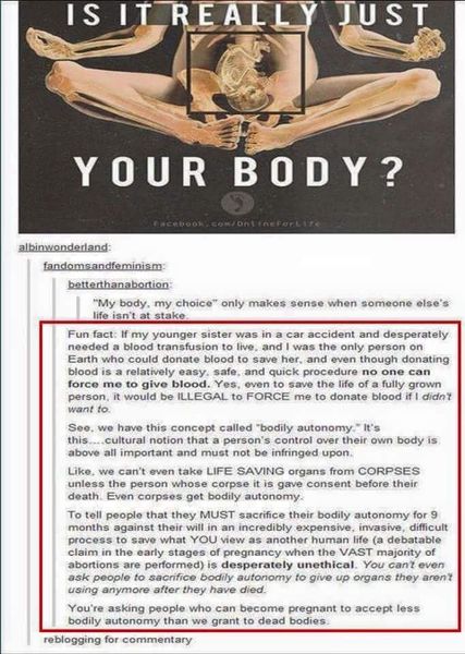 To assume if you are anti-abortion, you are...
