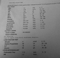 TTC after recurrent miscarriage thread 2 - we're not giving up