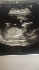 Any guesses on the gender??