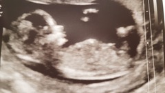 Early scan?