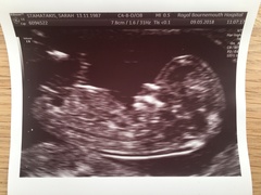 Guess the gender! 12 week scan