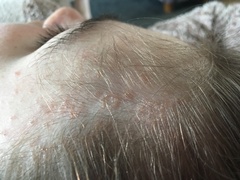 What's this in dds hair