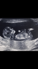Boy or girl