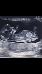 Boy or girl