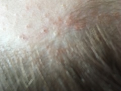 What's this in dds hair