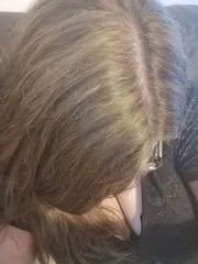 Need some help with hair! (Bleaching)