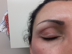 Is this allergy? Pics