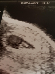 Early scan?