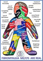 Fibromyalgia