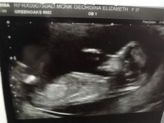 Any guesses on the gender??