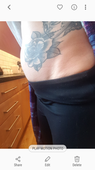 Cancer support thread 62 - here comes the sun (hopefully)