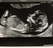 12+6 Boy or Girl just for fun!