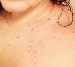 To ask what this rash looks like?