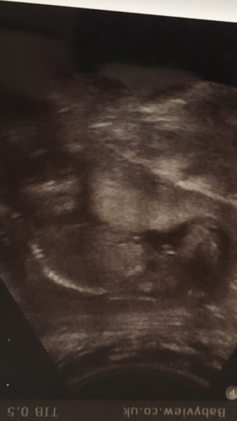 Scan picture inbetween the legs! Boy or girl?