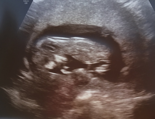 December 2018 Babies - Thread #2