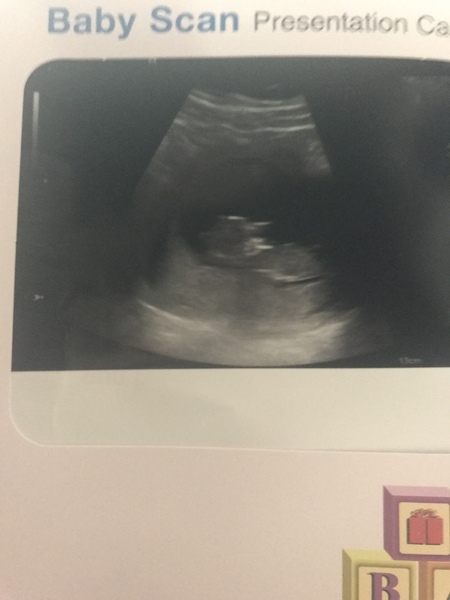 December 2018 Babies - Thread #2