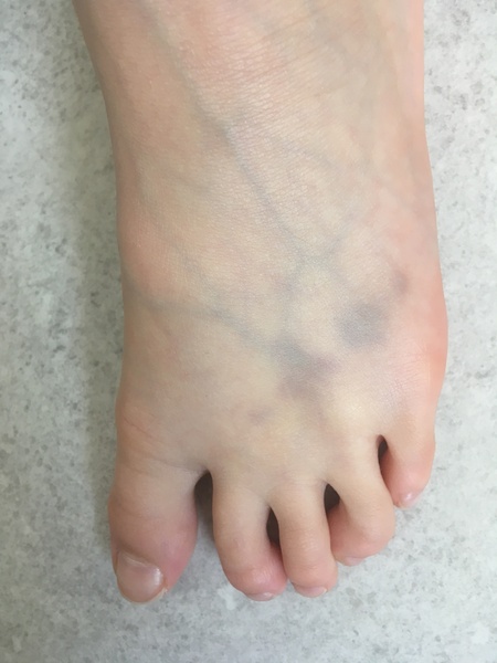 Should I be worried about this on dc’s foot?