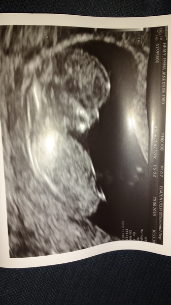 Newbie to the pregnancy board! Due end of December.. anyone else due around the same time?