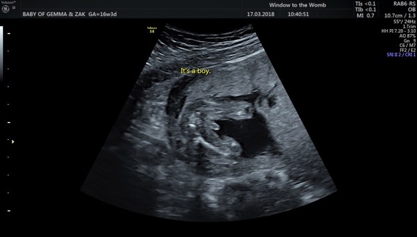 Scan picture inbetween the legs! Boy or girl?