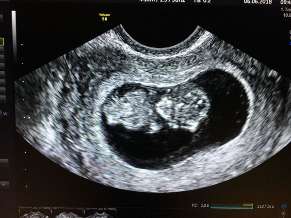 January 2019, thread 2