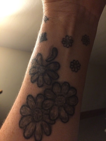 Self harm scar on arm