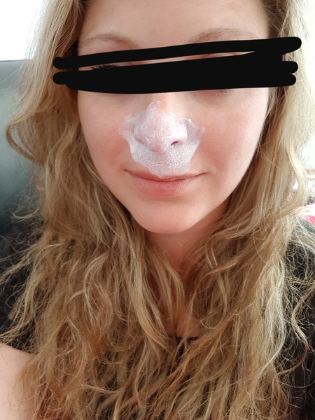 Warning disgusting pic! Sinus drain round 2