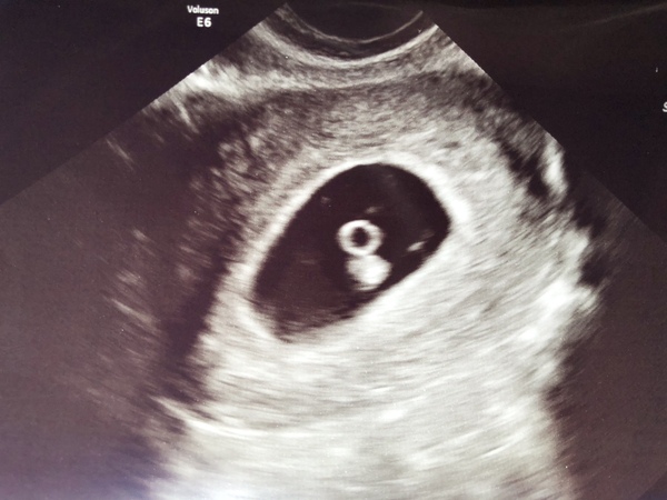 Due February 2019 part 2