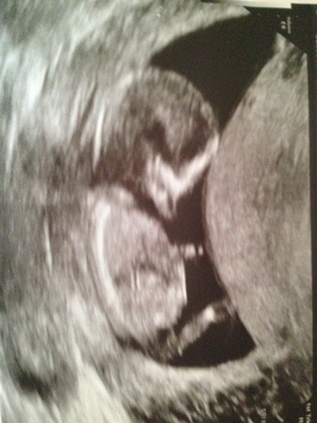 More cake for more babies... BFP after MC