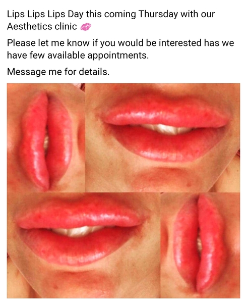 AIBU to think these lips lool awful!?