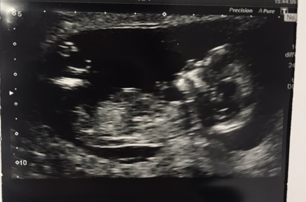 December 2018 Babies - Thread #3