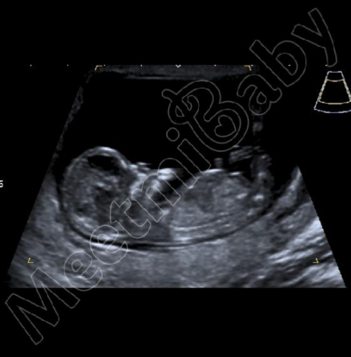 Boy or girl? Any guesses!!!