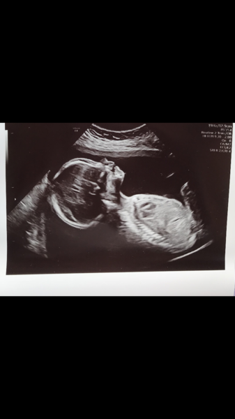 October 2018 baby bus part 3