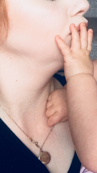 Double chin