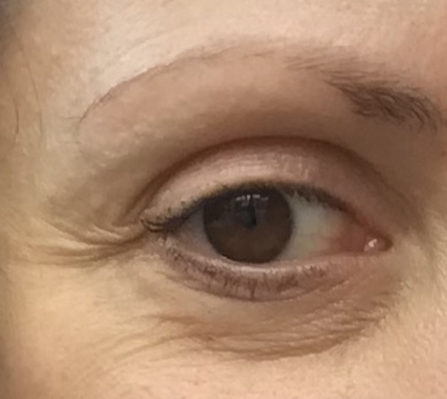 What can I do about this? Pic included